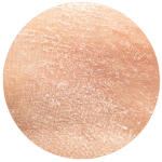 Dehydrated Skin